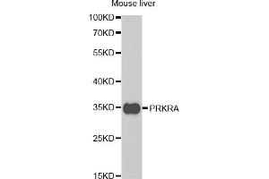 Western blot analysis of extracts of mouse liver, using PRKRA antibody (ABIN5973144) at 1/1000 dilution. (PRKRA 抗体)