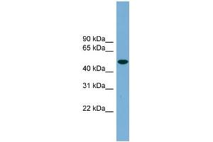 WB Suggested Anti-UBQLNL Antibody Titration: 0. (UBQLNL 抗体  (Middle Region))