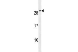 CFC1B antibody western blot analysis in NCI-H292 lysate (CFC1B 抗体  (AA 20-48))