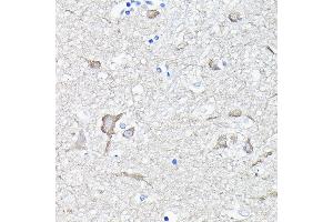 Immunohistochemistry of paraffin-embedded human brain using EEF1 Rabbit pAb (ABIN6129010, ABIN6139947, ABIN6139948 and ABIN6223167) at dilution of 1:100 (40x lens). (EEF1A2 抗体  (AA 184-463))