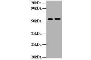 Western blot All lanes: MMP12 antibody at 2 μg/mL Lane 1: Hela whole cell lysate Lane 2: NIH/3T3 whole cell lysate Secondary Goat polyclonal to rabbit IgG at 1/10000 dilution Predicted band size: 55 kDa Observed band size: 55 kDa (MMP12 抗体  (AA 109-470))