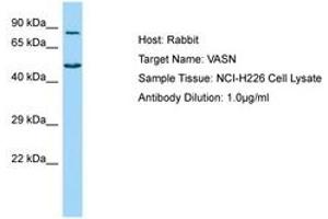 Image no. 1 for anti-Vasorin (Vasn) (AA 521-570) antibody (ABIN6750146) (Vasn 抗体  (AA 521-570))