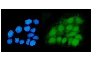 IF analysis of DHPS/DHS using anti-DHPS/DHS antibody (ABIN7601998). (DHPS 抗体  (AA 54-358))