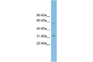 Western Blotting (WB) image for anti-Solute Carrier Family 39 (Zinc Transporter), Member 9 (SLC39A9) (Middle Region) antibody (ABIN2781660)