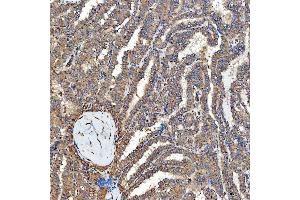 IHC analysis of SFXN3 using anti-SFXN3 antibody (ABIN7601302).