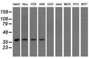 Image no. 2 for anti-3-hydroxyisobutyryl-CoA Hydrolase (HIBCH) antibody (ABIN1498654) (HIBCH 抗体)