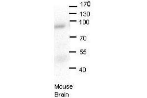 LSS antibody - N-terminal region  validated by WB using Mouse brains at 1:1000. (LSS 抗体  (N-Term))