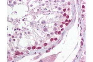 Anti-UNG antibody IHC of human testis. (UNG 抗体  (AA 281-298))