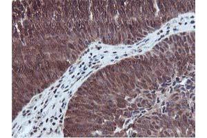 Image no. 4 for anti-RuvB-Like 2 (E. Coli) (RUVBL2) (AA 113-370) antibody (ABIN1490850)