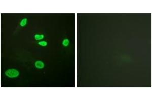 Immunofluorescence analysis of HeLa cells, using Histone H3 (Acetyl-Lys9) Antibody. (Histone 3 抗体  (H3K9ac))