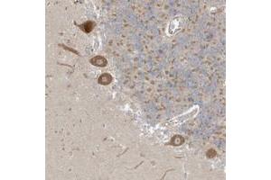 Immunohistochemical staining of human cerebellum with NPPC polyclonal antibody  shows moderate cytoplasmic positivity in purkinje cells. (NPPC 抗体)