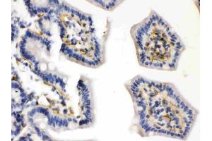 Caldesmon was detected in paraffin-embedded sections of mouse intestine tissues using rabbit anti- Caldesmon Antigen Affinity purified polyclonal antibody (Catalog # ) at 1 µg/mL. (Caldesmon 抗体  (AA 1-120))