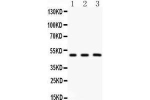 Western Blotting (WB) image for anti-GATA Binding Protein 3 (GATA3) (AA 1-197) antibody (ABIN3042417)