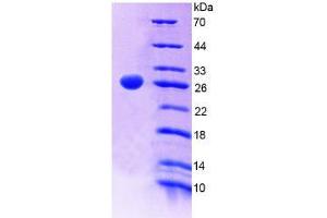 SDS-PAGE analysis of Human PTPRF Protein. (PTPRF 蛋白)