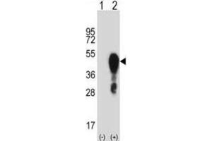 Western Blotting (WB) image for anti-Homeobox A1 (HOXA1) antibody (ABIN2998004) (HOXA1 抗体)