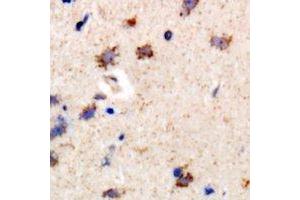 Immunohistochemical analysis of PIP4K2 beta staining in rat brain formalin fixed paraffin embedded tissue section. (PIP4K2B 抗体)