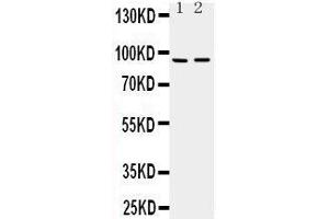 Anti-ADAMTS4 antibody, Western blotting Lane 1: Rat Brain Tissue Lysate Lane 2: Mouse Brain Tissue Lysate (ADAMTS4 抗体  (C-Term))