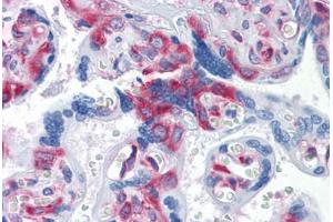 Human Placenta: Formalin-Fixed, Paraffin-Embedded (FFPE) (G3BP1 抗体  (AA 214-303))