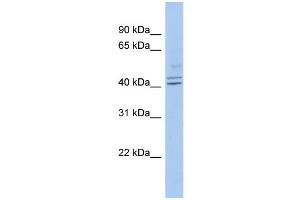 WB Suggested Anti-PROCA1 Antibody Titration: 0. (PROCA1 抗体  (Middle Region))