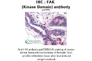 Image no. 1 for anti-PTK2 Protein tyrosine Kinase 2 (PTK2) antibody (ABIN1734244) (FAK 抗体)