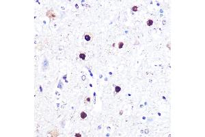 Immunohistochemistry of paraffin-embedded mouse spinal cord using  Rabbit pAb  at dilution of 1:100 (40x lens). (ATF2 抗体)