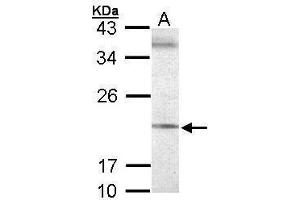 WB Image Sample (30 ug of whole cell lysate) A: 293T 12% SDS PAGE antibody diluted at 1:500 (SEC61G 抗体  (Center))