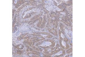 IHC analysis of WDR44 using anti-WDR44 antibody (ABIN7600394). (WDR44 抗体  (AA 188-913))
