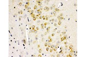 IHC-P: GLUR2 antibody testing of rat brain tissue (GRIA2 抗体  (AA 25-360))