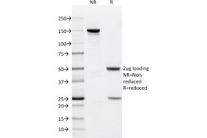 SDS-PAGE (SDS) image for anti-CD9 (CD9) antibody (ABIN6941084)
