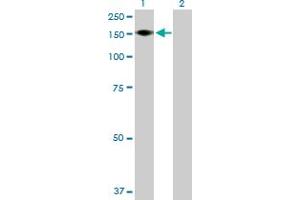 Western Blotting (WB) image for anti-ADAM Metallopeptidase with thrombospondin Type 1 Motif, 18 (ADAMTS18) (AA 1-1221) antibody (ABIN531219)