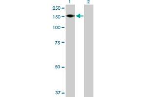 Western Blot analysis of ADAMTS18 expression in transfected 293T cell line by ADAMTS18 MaxPab polyclonal antibody. (ADAMTS18 抗体  (AA 1-1221))