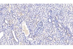 Immunohistochemistry (IHC) image for anti-ATP-Binding Cassette, Sub-Family B (MDR/TAP), Member 10 (ABCB10) (AA 492-738) antibody (ABIN7444994)