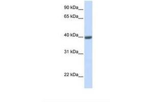 Image no. 1 for anti-Melanoma Antigen Family A, 1 (Directs Expression of Antigen MZ2-E) (MAGEA1) (AA 38-87) antibody (ABIN6749734) (MAGEA1 抗体  (AA 38-87))