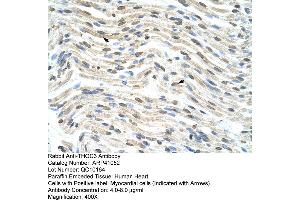 Rabbit Anti-THOC3 Antibody  Paraffin Embedded Tissue: Human Heart Cellular Data: Myocardial cells Antibody Concentration: 4. (THO Complex 3 抗体  (Middle Region))