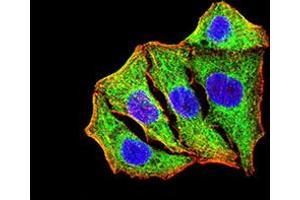 Immunocytochemistry (ICC) image for anti-Superoxide Dismutase 2, Mitochondrial (SOD2) (AA 1-222) antibody (ABIN5888812) (SOD2 抗体  (AA 1-222))