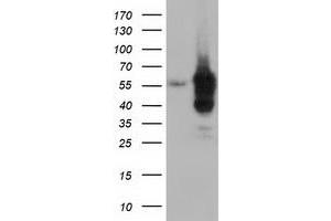 Western Blotting (WB) image for anti-Dynein, Cytoplasmic 1, Light Intermediate Chain 1 (DYNC1LI1) antibody (ABIN1497933) (DYNC1LI1 抗体)