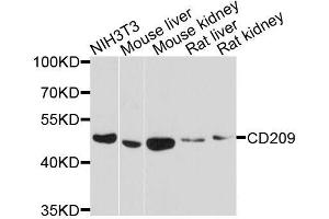 Western blot analysis of extracts of various cell lines, using CD209 antibody. (DC-SIGN/CD209 抗体  (AA 265-404))
