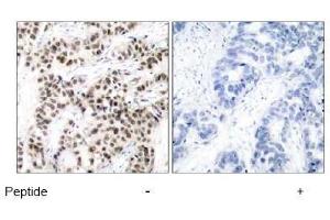 Image no. 2 for anti-Myc Proto-Oncogene protein (MYC) (Thr58) antibody (ABIN197154) (c-MYC 抗体  (Thr58))