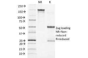 SDS-PAGE Analysis Purified ACTH Monoclonal Antibody (CLIP/1449).