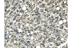 IHC analysis of DROSHA using anti-DROSHA antibody (ABIN7599763).