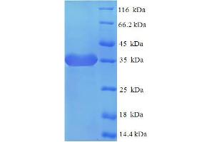 SDS-PAGE (SDS) image for Signal-Regulatory Protein delta (SIRPD) (AA 30-197) protein (His-SUMO Tag) (ABIN5710364) (SIRPD Protein (AA 30-197) (His-SUMO Tag))
