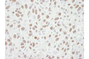 Immunohistochemistry (IHC) image for anti-Minichromosome Maintenance Complex Component 6 (MCM6) (C-Term) antibody (ABIN7448656)