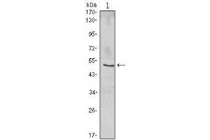 Western Blot showing NFKBIB antibody used against Jurkat (1) cell lysate.