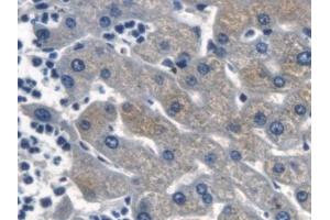 Detection of β-catenin in Human Liver Tissue using Polyclonal Antibody to Beta Catenin (β-catenin) (beta Catenin 抗体  (AA 439-675))