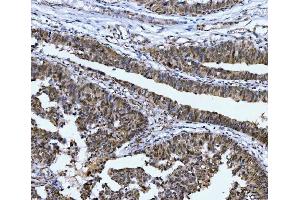 IHC analysis of CSNK2K2 using anti-CSNK2K2 antibody (ABIN7602871).