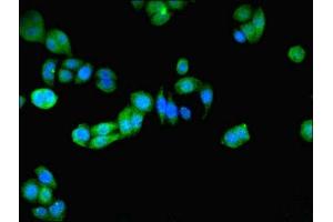 Immunofluorescent analysis of PC-3 cells using ABIN7162944 at dilution of 1:100 and Alexa Fluor 488-congugated AffiniPure Goat Anti-Rabbit IgG(H+L) (Peroxiredoxin 5 抗体  (AA 53-214))
