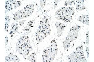 RBM22 antibody was used for immunohistochemistry at a concentration of 4-8 ug/ml to stain Skeletal muscle cells (arrows) in Human Muscle.