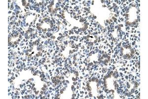 SLC43A3 antibody was used for immunohistochemistry at a concentration of 4-8 ug/ml to stain Alveolar cells (arrows) in Human Lung. (SLC43A3 抗体  (N-Term))