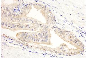 anti-KN Motif and Ankyrin Repeat Domains 2 (KANK2) (AA 550-600) antibody