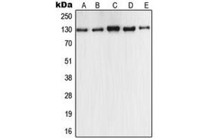 Western blot analysis of iNOS expression in MCF7 (A), A549 (B), Raw264. (NOS2 抗体  (C-Term))